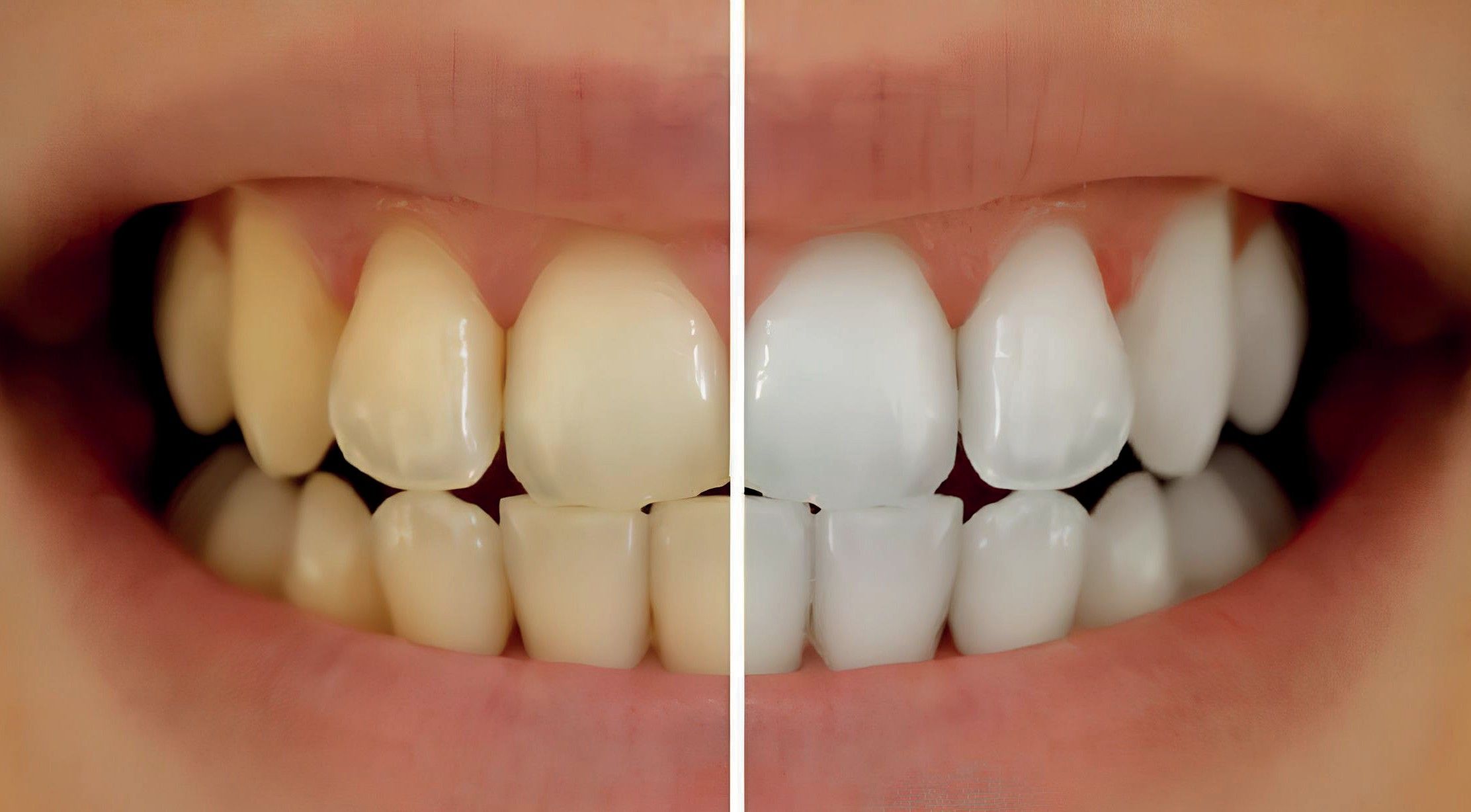 TÜRKİYE'NİN DİŞ SAĞLIĞI TURİZMİNDEKİ ETİK LİDERLİĞİ