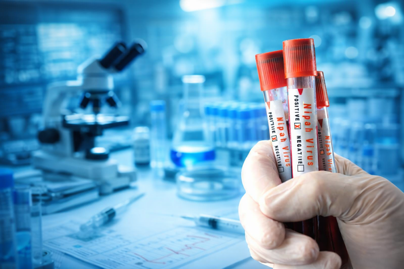 Nipah Virüsü (Niv) ile İlgili Merak Edilenler Vaka Ölüm Oranı Yüzde 40 ile Yüzde 75 Arasında Değişiyor